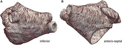 A Computational Framework to Benchmark Basket Catheter Guided Ablation in Atrial Fibrillation